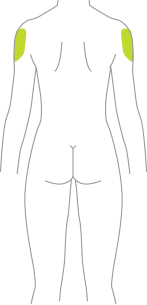 Areas on the body where Tresiba® can be injected