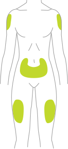 Areas on the body where Tresiba® can be injected