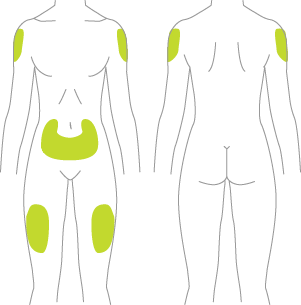 Areas on the body where Tresiba® can be injected