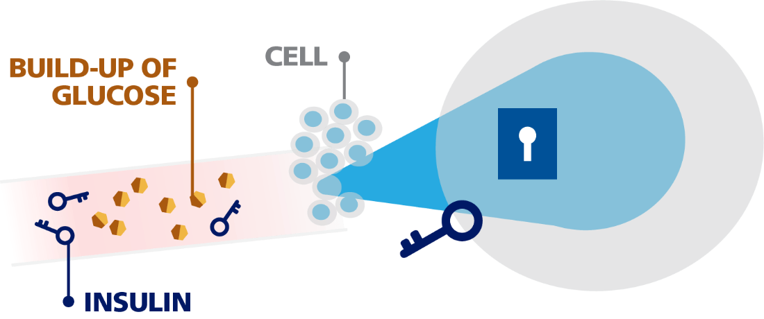 Build-up of blood glucose in the blood illustration